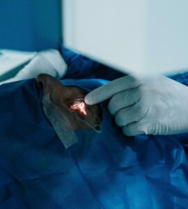 Opération laser des yeux à Annecy : choisissez une vision nette et durable