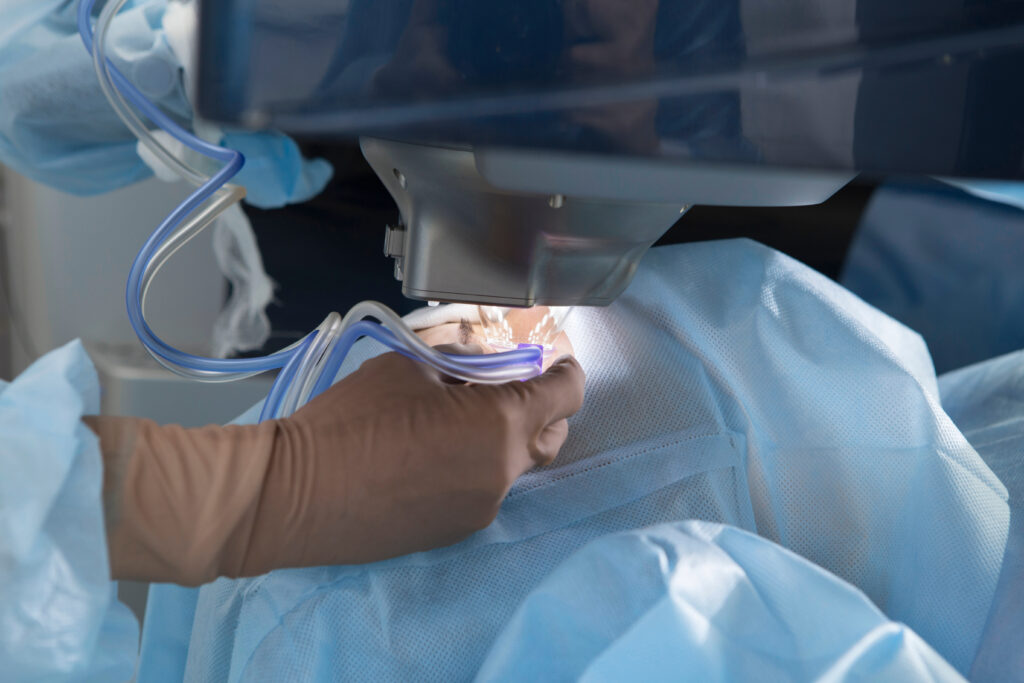 Opération des yeux à Saint-Étienne