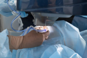 Opération des yeux à Saint-Étienne