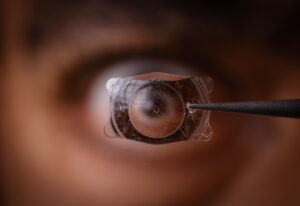 Chirurgie réfractive à Chambéry