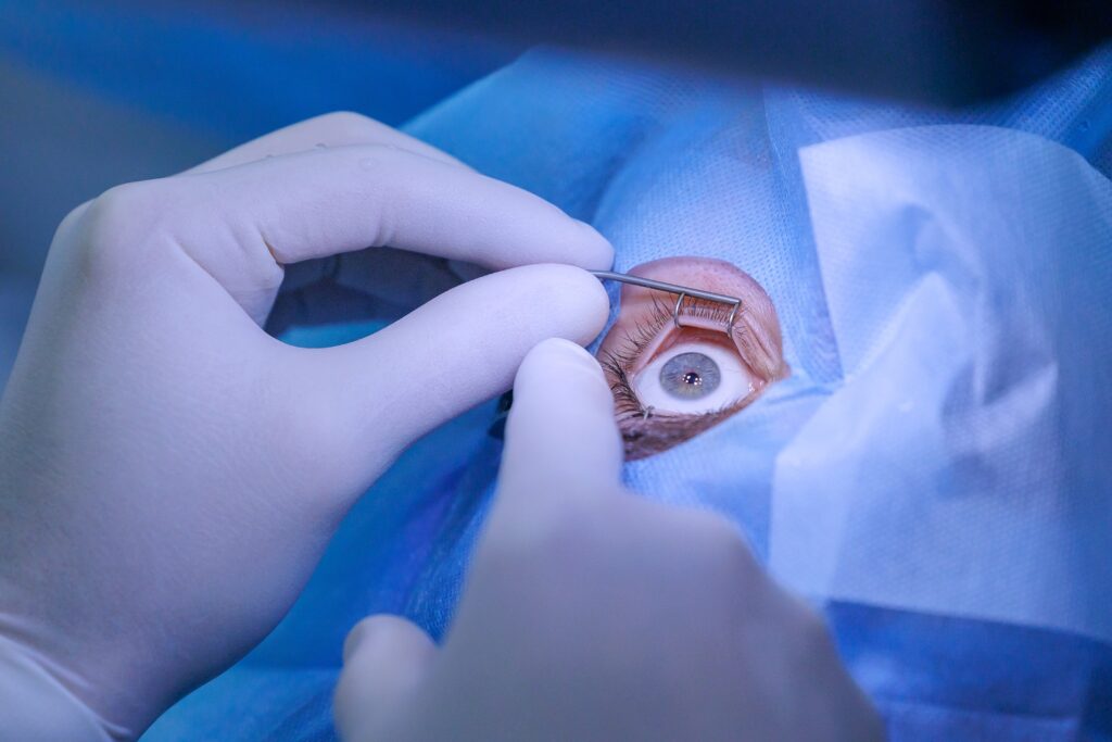 Vous recherchez un spécialiste de la chirurgie réfractive à Clermont-Ferrand pour corriger votre myopie, hypermétropie, astigmatisme ou presbytie ? Le Dr Yoann Soldermann, chirurgien ophtalmologue reconnu en chirurgie de la vision, accueille les patients de Clermont-Ferrand et du Puy-de-Dôme souhaitant se libérer de leurs lunettes ou lentilles grâce aux techniques les plus avancées.