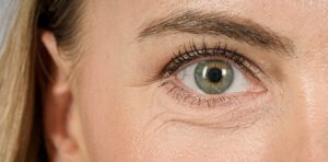 Opération laser des yeux à Saint-Étienne